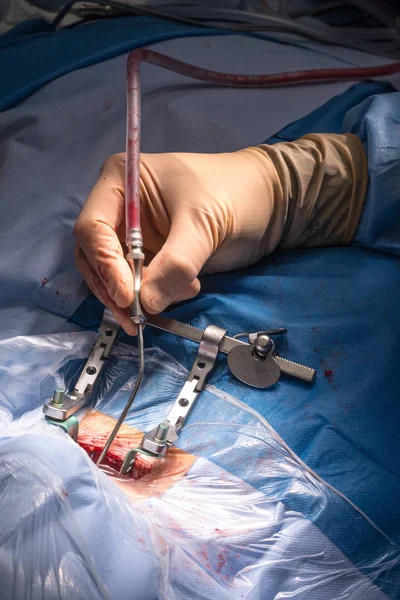 Surgical operation in the operating room — Stock Photo, Image