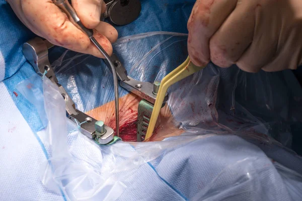 Surgical operation in the operating room — Stock Photo, Image