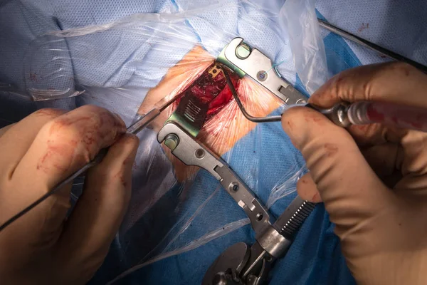 Operasi bedah di ruang operasi — Stok Foto