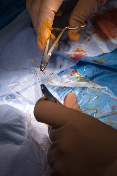 Chirurgische ingreep in de operatiekamer — Stockfoto