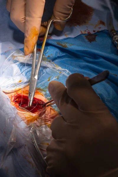 Operação cirúrgica na sala de cirurgia — Fotografia de Stock