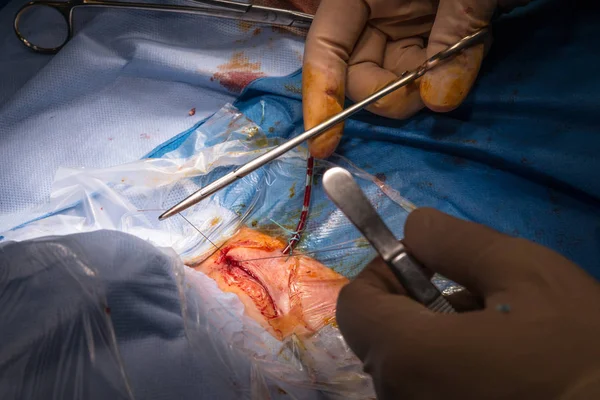 Χειρουργική επέμβαση στο χειρουργείο — Φωτογραφία Αρχείου