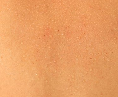 İnsan derisi ve ter