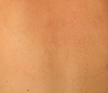 İnsan derisi ve ter