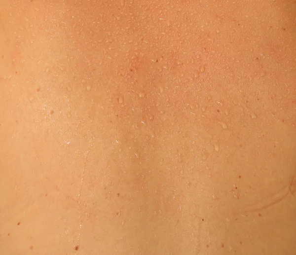 人間の皮膚と汗 — ストック写真