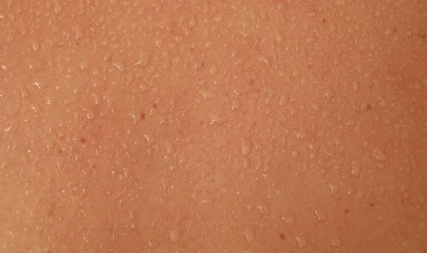 Menselijke huid en zweet — Stockfoto