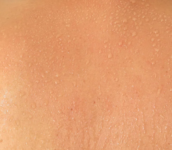 人間の皮膚と汗 — ストック写真