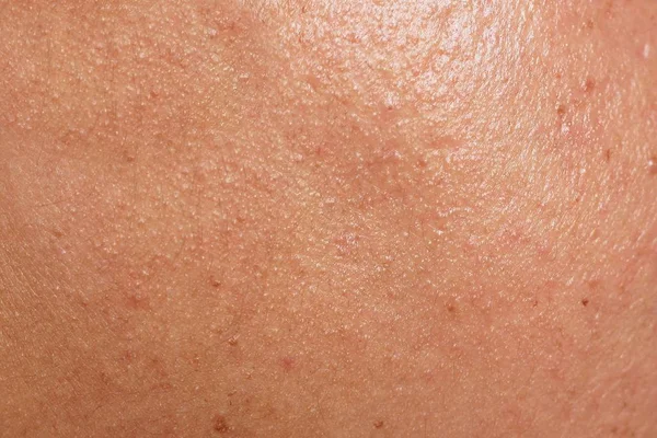 Mänsklig hud textur — Stockfoto