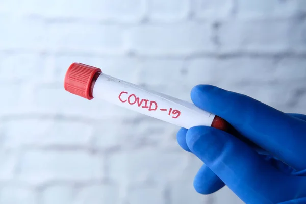laboratory technician testing corona virus , COVID 19 test.