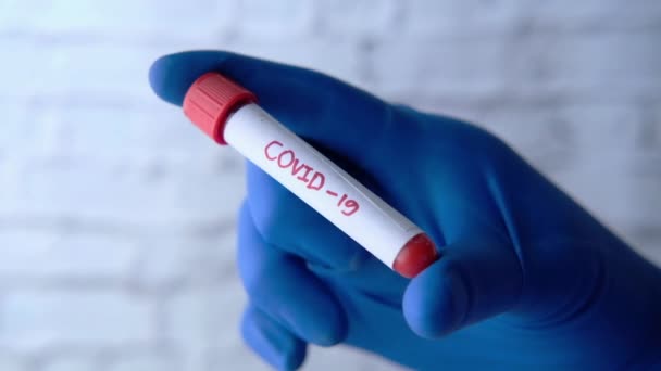 Лаборант тестирует коронный вирус, тест COVID 19. — стоковое видео