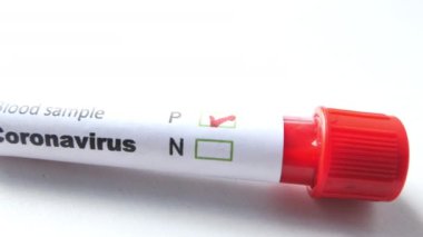 Kan tüpü testinin kapanışı. Corona virüs etiketi.