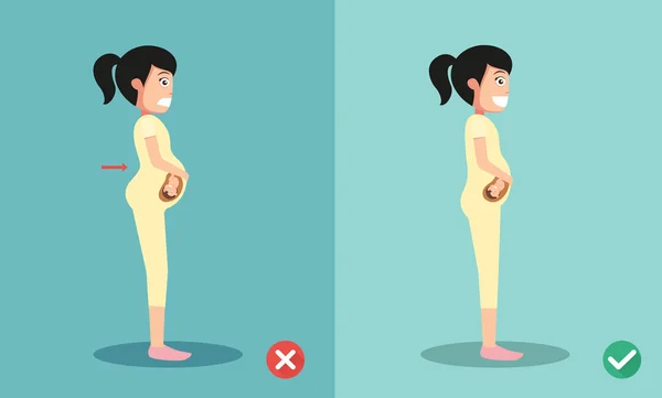 Meilleures et pires positions pour les femmes enceintes debout, illustrati — Image vectorielle