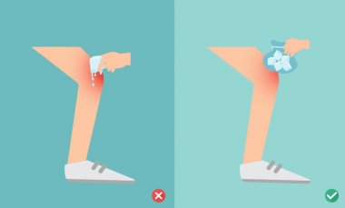 doğru ve yanlış yolları İlkyardım yaralanma için soğuk paketleri kullanarak ben