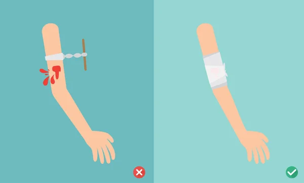 Maneras equivocadas y correctas tratamiento de emergencia de primeros auxilios, ilustración — Vector de stock