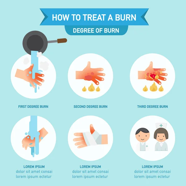 How to treat a burn infographic,vector illustration — Stock Vector