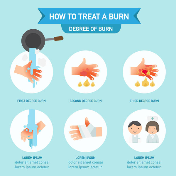 How to treat a burn infographic,vector illustration