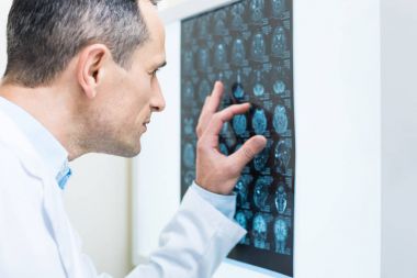 Bilgisayarlı tomografi sonuçlarını analiz doktoru yakın çekim