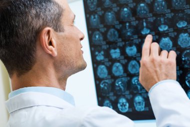 Erkek doktor bilgisayar tomografi sonuçları üzerinden arıyor