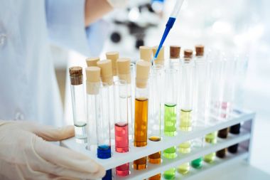 Birçok test tüpleri üzerinde özel destek ayakta