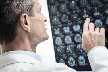 X ray tarama eğitim yakışıklı profesyonel nörolog