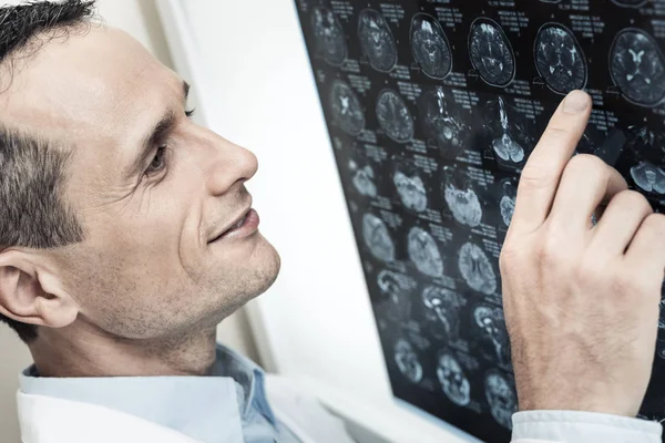 Médico inteligente positivo apontando para a varredura de raios X — Fotografia de Stock