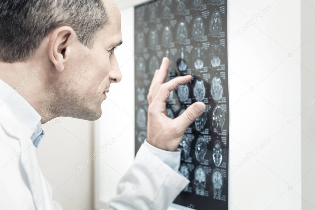 Nice handsome doctor looking at the X ray image