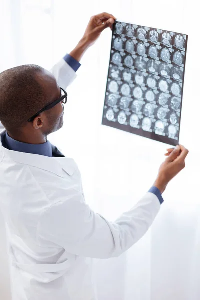 Behendig mannelijke arts onderzoek naar beeldvorming van de hersenen — Stockfoto