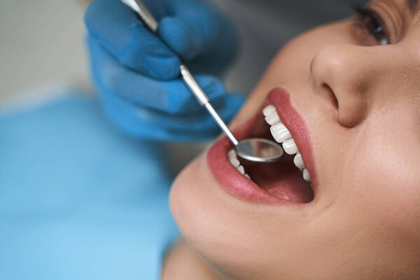 Young girl during dental examination stock photo