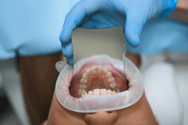 Mujer con herramienta dental en la boca stock foto — Foto de Stock