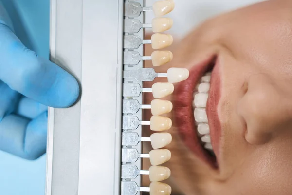 Верхний вид стоматолога с палитрой шпона фото — стоковое фото