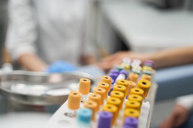 Test tüplerinde bulunan plastik parçaları kapat