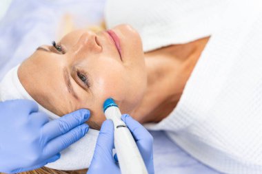 Bir kozmetikçi tarafından gerçekleştirilen mikro dermabrasyon prosedürü