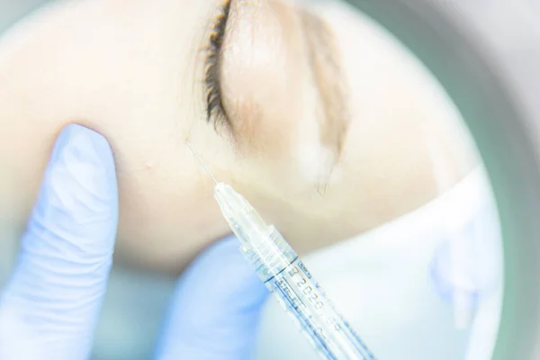 Kvinna som får en injektion i området under ögat — Stockfoto