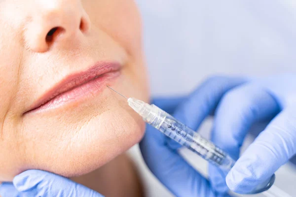 Patient recevant une micro-injection dans la lèvre inférieure — Photo