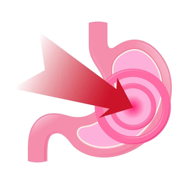 Stomach Intestine Icon With Arrow Targeting Tot The Pain Source — Stock Vector