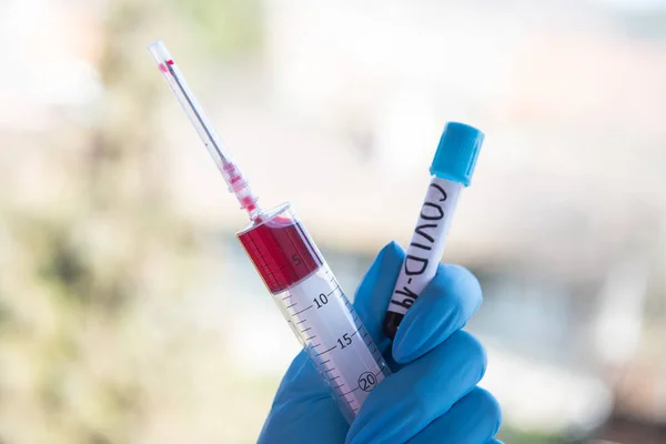 注射器と血液とテストでCovid Sars Mers — ストック写真