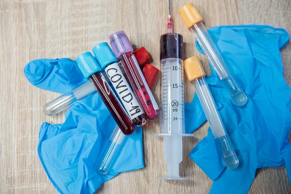 Tube Blood Test Covid — Stock Photo, Image