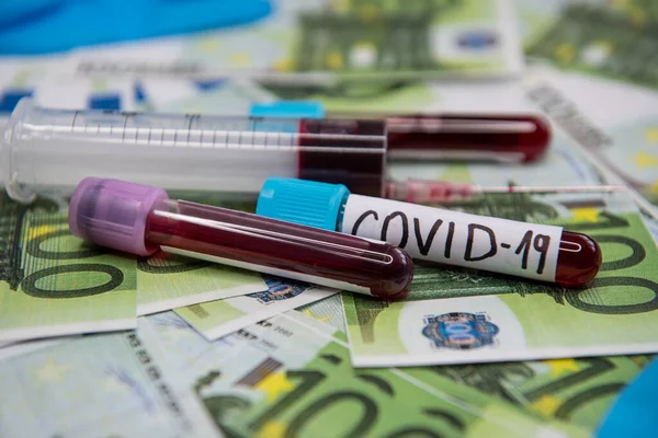 Economic Situation Euro Disease Covid — Stock Photo, Image