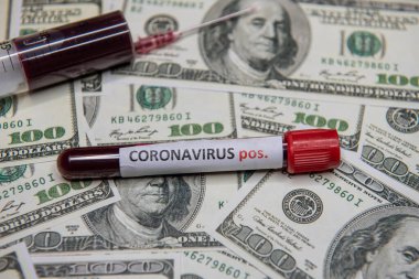 Doların ekonomik durumu ve Coronavirus 'taki pozitif test.