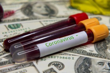 Coronavirüs 'te dolar ve negatif test.