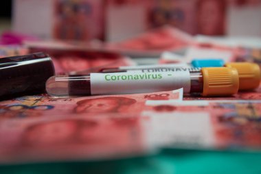 Çin yuanı ve koronavirüs testi negatif..