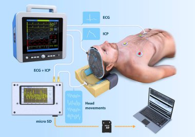 Ecg, Icp, tansiyon göstergesi EKG monitörü, intrakraniyal basınç, kateter, hasta, kafa hareketleri, mikro sd kartı, EKG monitörü, beyin, dizüstü bilgisayar