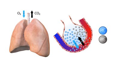 anatomy of the lungs, alveoli, gas transfer in the lungs, oxygenation of the blood, respiratory system, pneumonia, clipart