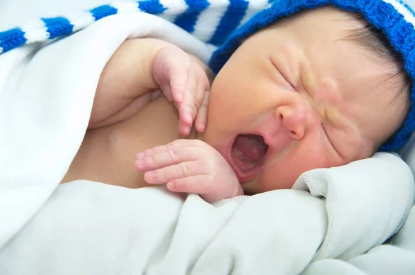 Grappige baby gezicht in de hoed, pasgeboren met geelzucht op witte deken, baby gezondheidszorg concept — Stockfoto
