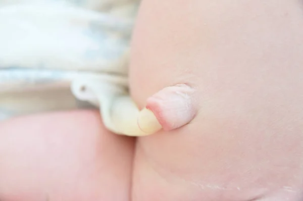 Umbilical cord just new born in first day of life — Stock Photo, Image