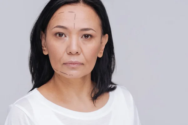 Lady posing with pre surgery marks — Stock Photo, Image