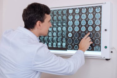 Yakışıklı genç doktor X ray fotoğraf işaret