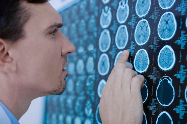 Ciddi yakışıklı Doktor Röntgen fotoğraf incelenmesi