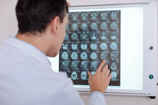 Професійний чоловічий лікар, дивлячись на зображення рентгенівського променя — стокове фото