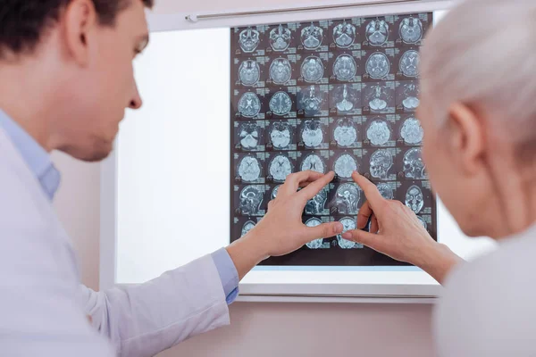 Mujer anciana agradable apuntando a la imagen de rayos X del cerebro — Foto de Stock